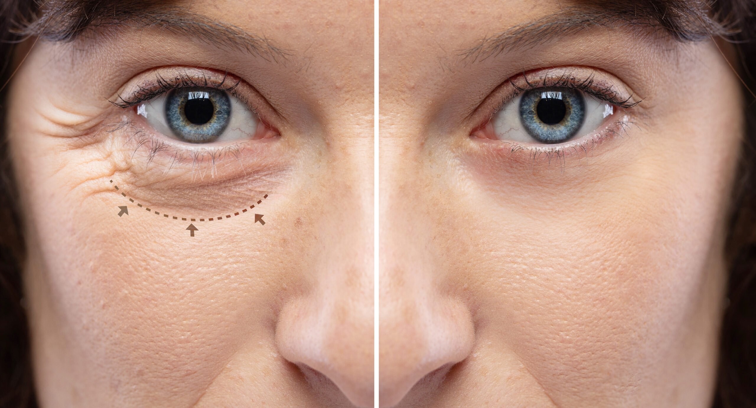 Downtime and Recovery: What to Expect Post-Treatment