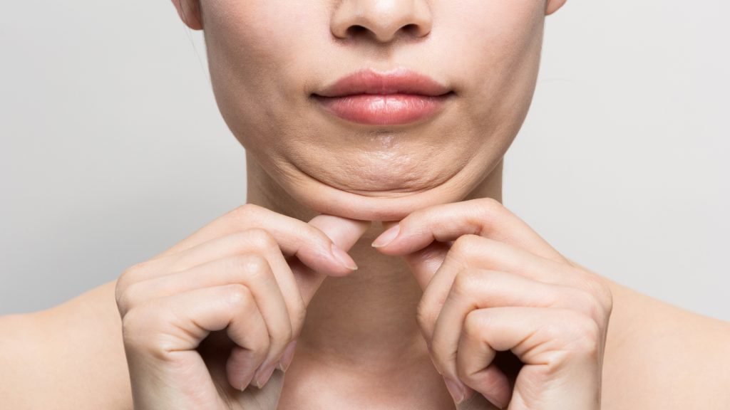 Factors That Affect Chin Liposuction Cost