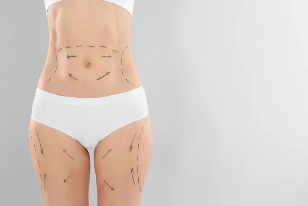 Minimizing Scarring: Pre- and Post-Operative Care