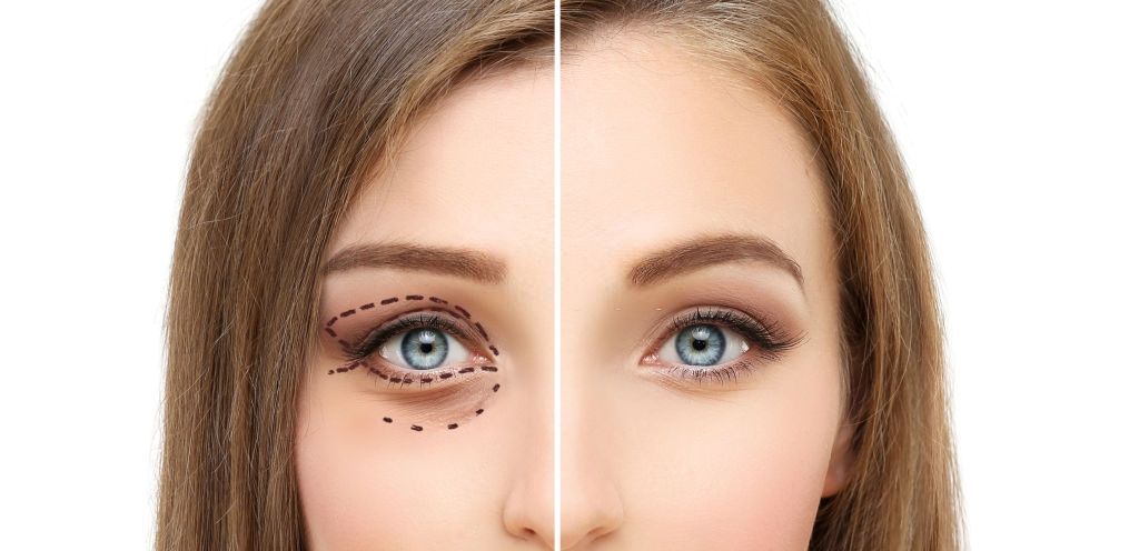 Non-Surgical Facial Aesthetics: Fillers, Botox, and More