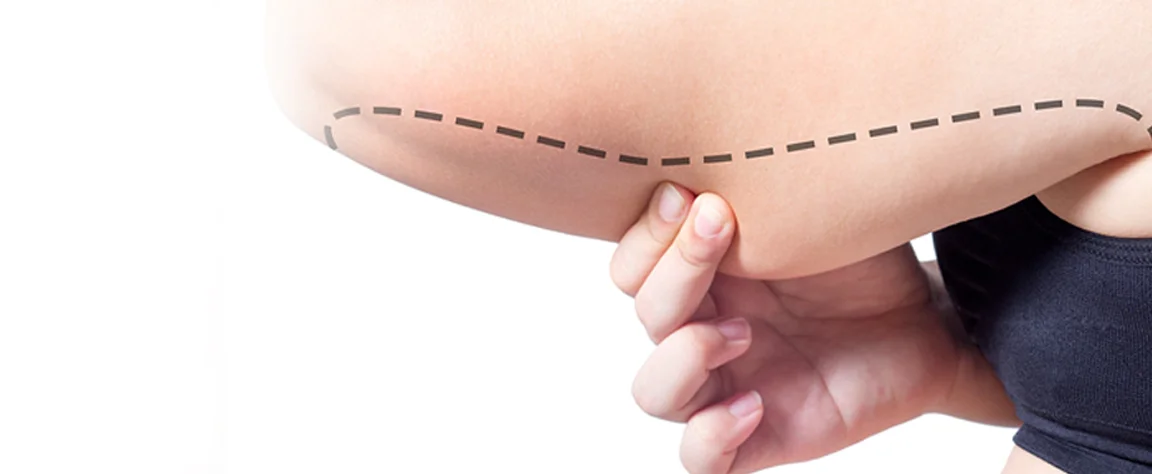 Potential Risks and Complications of Arm Liposuction