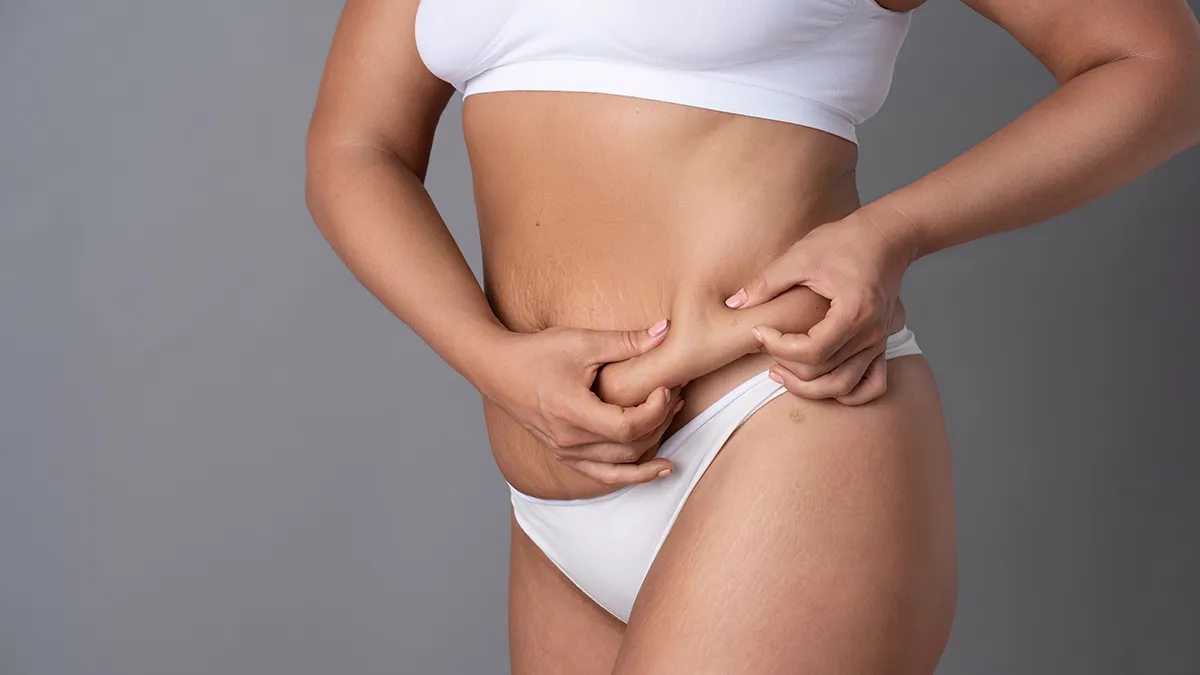 Aesthetic Goals of Belly Button Reconstruction