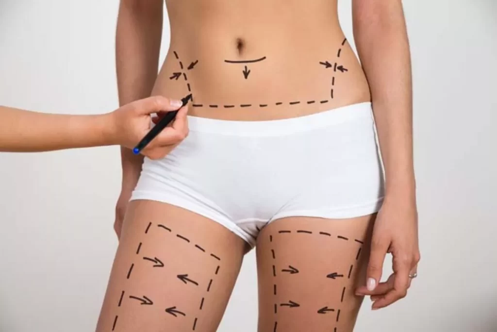 Immediate Post-Operative Care and Timeframe