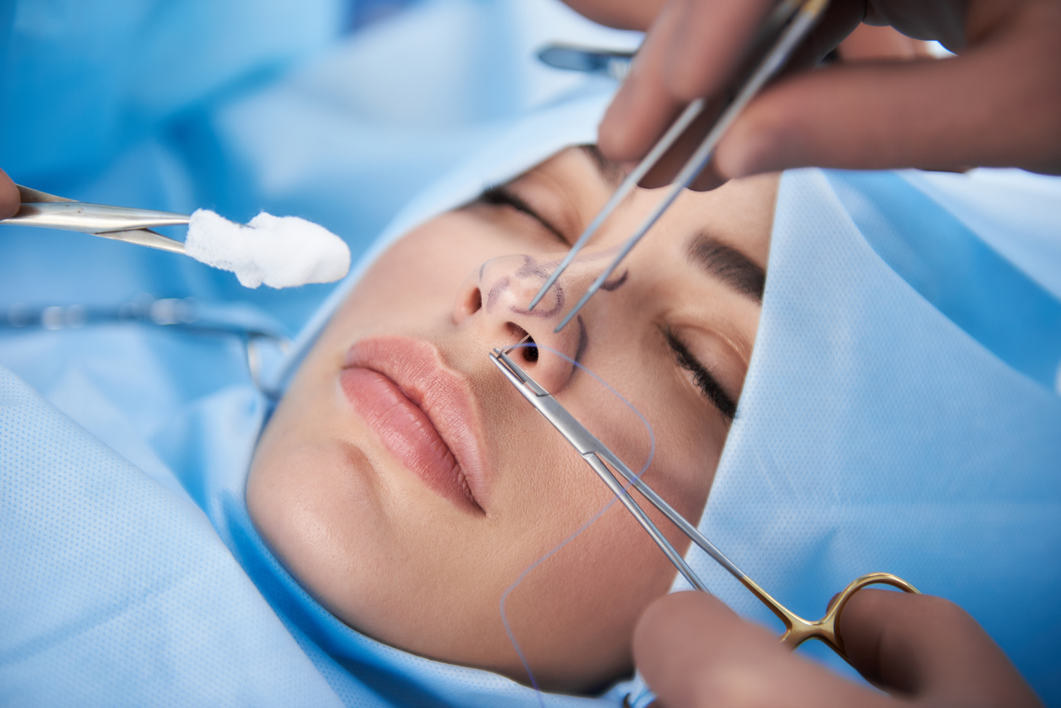 Potential Risks and Complications of Nose Reshaping