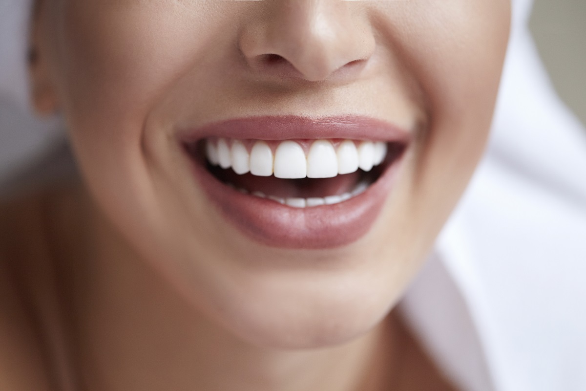 Factors Influencing the Price of Teeth Whitening