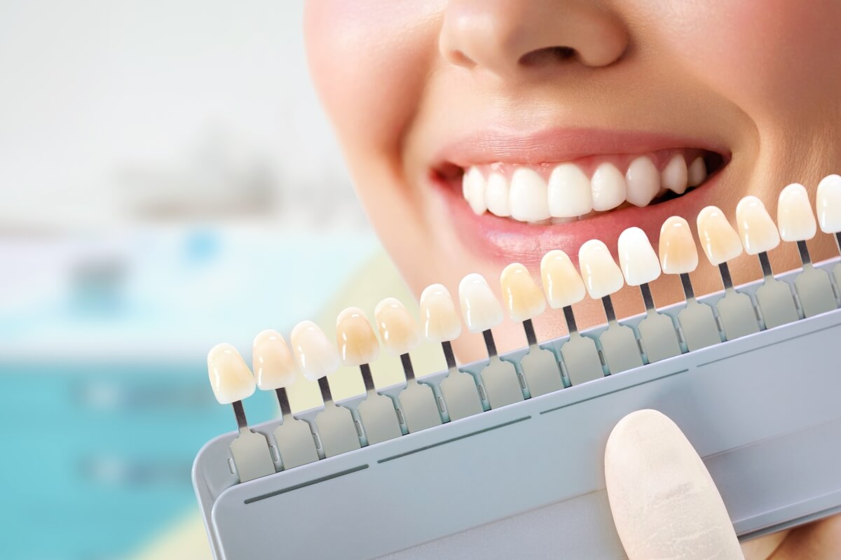Overview of Teeth Whitening Procedures