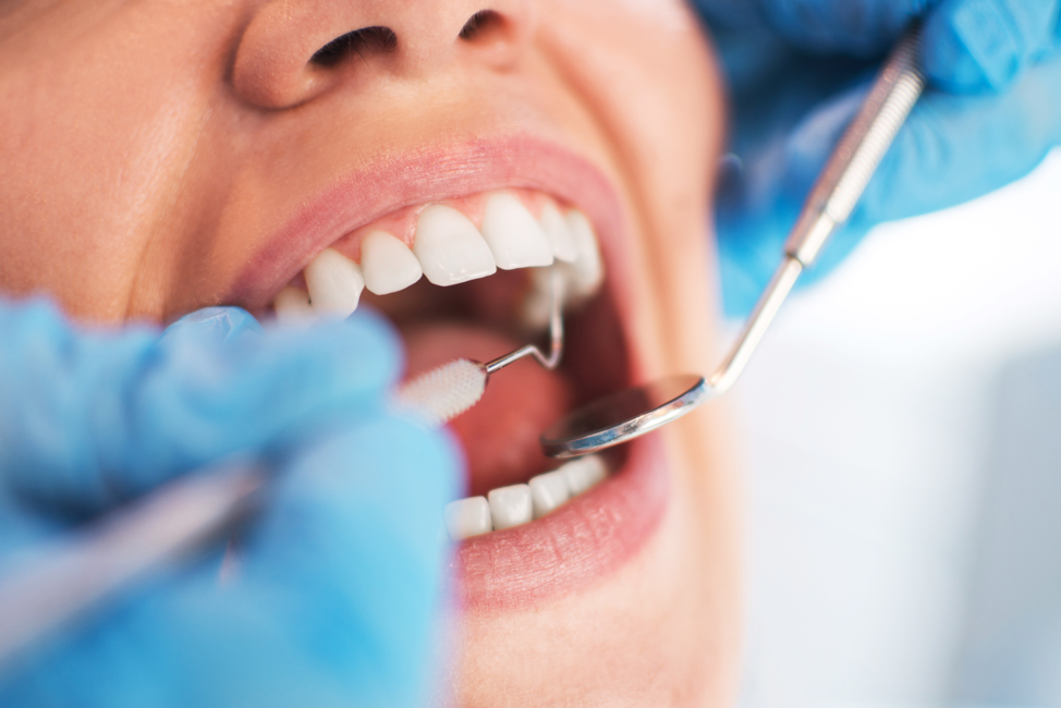 Recovery Process: What to Expect After Treating Implant Infections