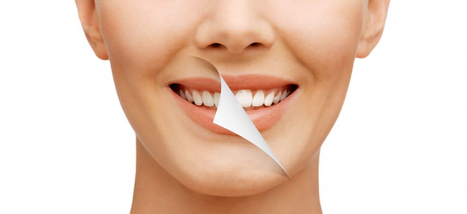 Smile Makeover Comprehensive Aesthetic Treatment