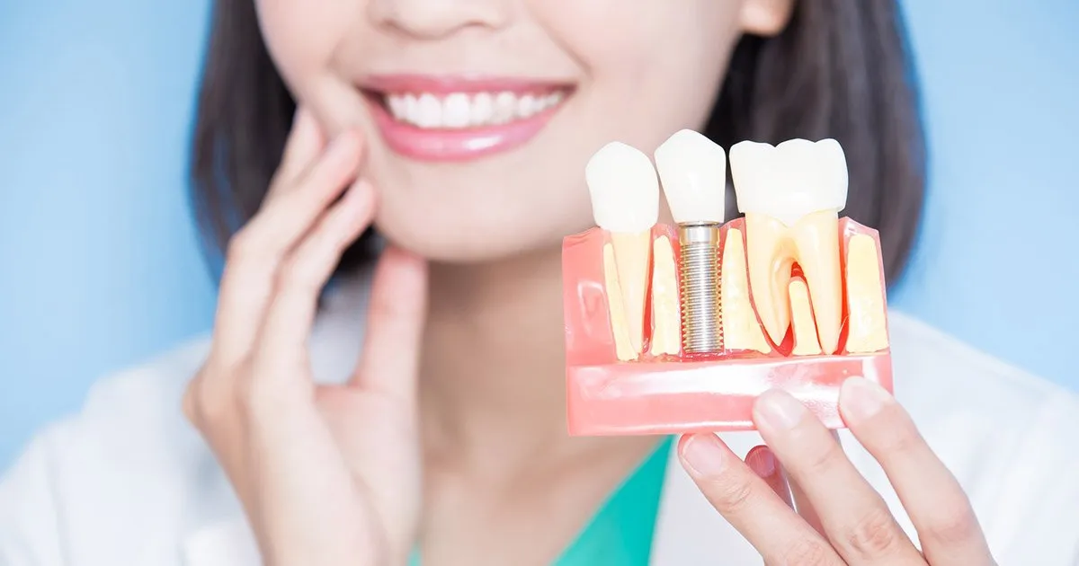 The Role of Oral Hygiene in Preventing Implant Infections