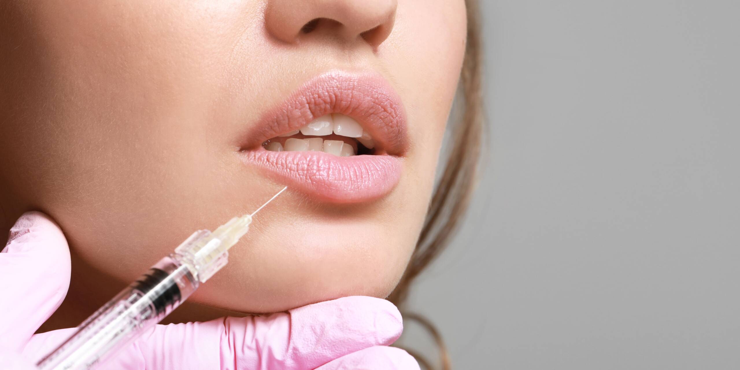 Introduction to Lip Filler Swelling: What to Expect
