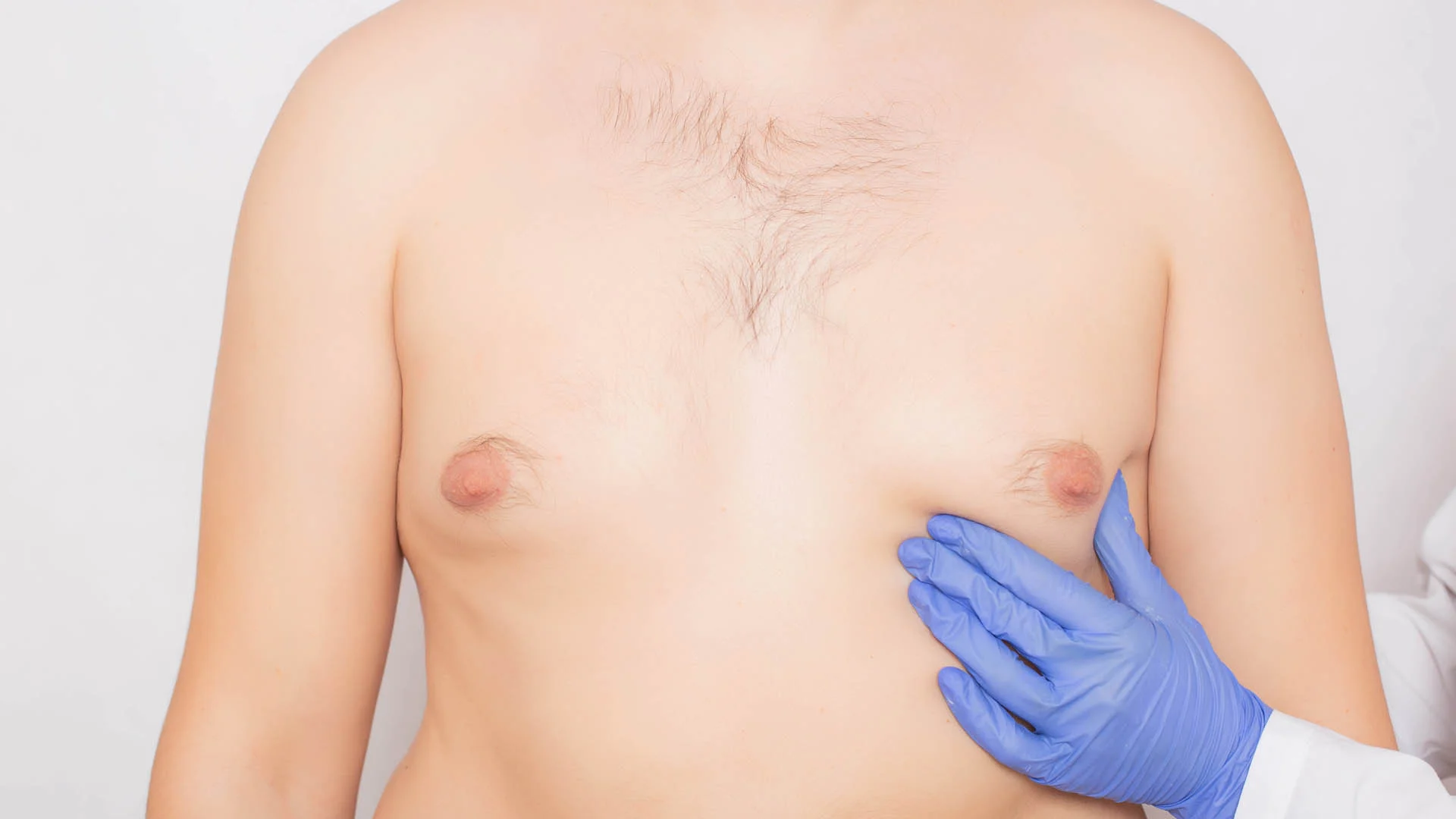 Financing Options for Gynecomastia Treatment