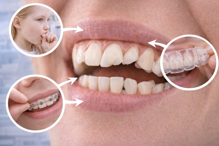 What Causes Tooth Curvature? What is the Solution?
