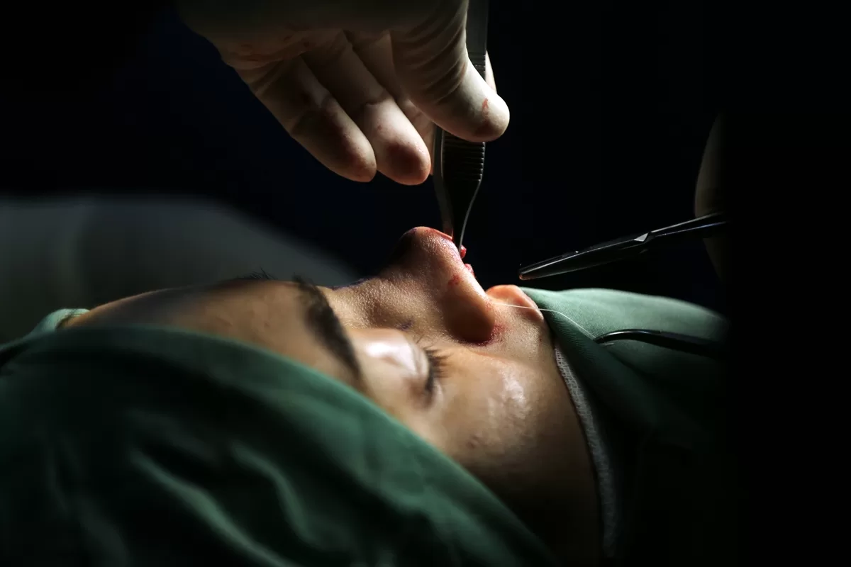 Cosmetic Surgery in Turkey